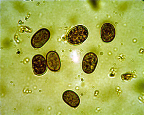 Amanita strobiliformis
